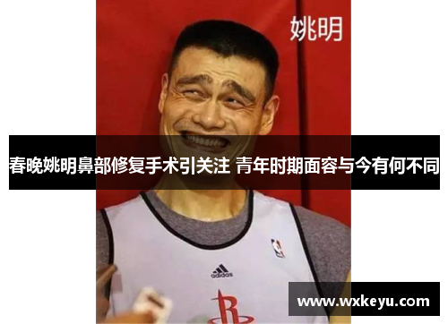 春晚姚明鼻部修复手术引关注 青年时期面容与今有何不同
